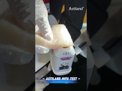 HIFU 에너지 테스트