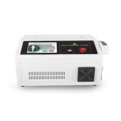 ISO 532nm 안료 큐는 ND 야그 레이저 기계를 바꾸었습니다